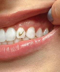 ISLA Berlin Yellow Gold Tooth Gems New Arrivals